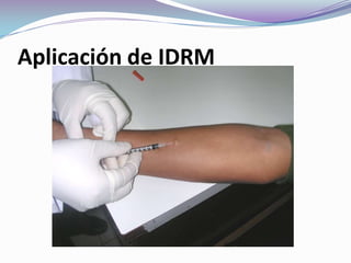 Aplicación de IDRM