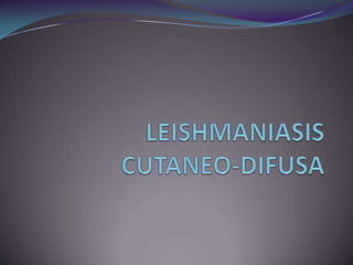 Amastigotes: mejora de sensibilidad y especificidadEnzimoinmunoensayo (ELISA) Presencia de Ac anti-Leishmania