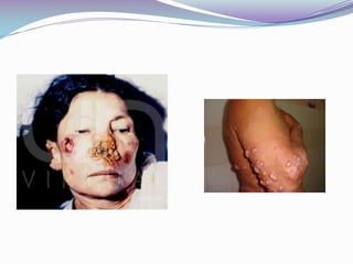  Diluciones de suero: permite establecer títulos de Ac