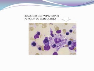 LEISHMANIASIS CUTANEA DEL VIEJO MUNDO En la forma húmeda existe el compromiso de los linfáticos regionales.La ulcera se extiende gradualmente y se profundiza.Los bordes levantados e hipertróficos, formación de un cráter, esta característica de la lesión le da el nombre de botón en los países orientales.DIAGNOSTICO:Examen parasitologico directo :Exámenes inmunologicos .Tratamiento: antimoniales pentavalentes : Glucantime.