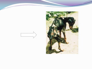    MANIFESTACIONES CLINICASEn etapas severas de la enfermedad, al  mal estado general  se suman las infecciones intercurrentes (tuberculosis , neumonía , disentería bacilar  y amebiana , que lleva al paciente a la muerte .