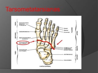 Tarsometatarsianas

 