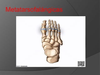Metatarsofalángicas

 