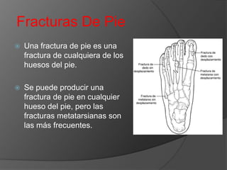 Fracturas De Pie


Una fractura de pie es una
fractura de cualquiera de los
huesos del pie.



Se puede producir una
fractura de pie en cualquier
hueso del pie, pero las
fracturas metatarsianas son
las más frecuentes.

 