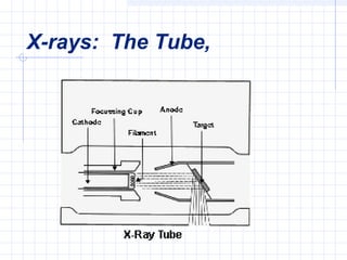 X-rays: The Tube,
 