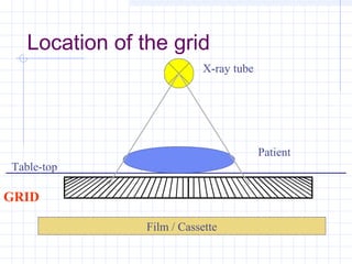 Location of the grid
Film / Cassette
GRID
Table-top
Patient
X-ray tube
 