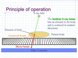 Principle of operation
X-ray tube
Patient body
Film / Cassette
Element of body
The incident X-ray beamincident X-ray beam
hits an element in the body
and is scattered in random
directions
Direct beam
Scattered beam
 
