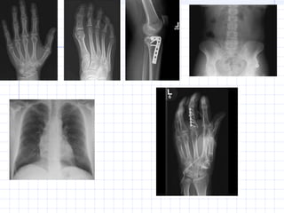 Tema  9_sistemas_de_rx