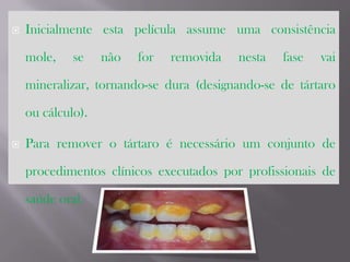 Inicialmente esta película assume uma consistência mole, se não for removida nesta fase vai mineralizar, tornando-se dura (designando-se de tártaro ou cálculo). Para remover o tártaro é necessário um conjunto de procedimentos clínicos executados por profissionais de saúde oral.
