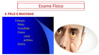 Exame Físico
9. PELE E MUCOSAS
 
