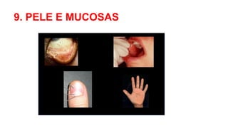 9. PELE E MUCOSAS
 