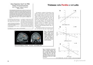 30 dr. gino martorelli
TristezzaTristezza nellanella PerditaPerdita e nele nel LuttoLutto
 