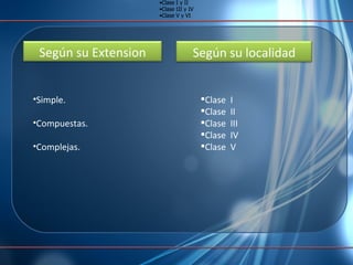 Simple.  Compuestas. Complejas. Clase I y II Clase III y IV Clase V y VI Clase I y II Clase III y IV Clase V y VI Clase  I Clase  II  Clase  III  Clase  IV Clase  V Según su Extension Según su localidad 
