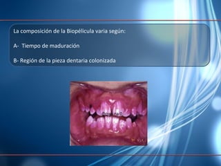 La composición de la Biopélicula varia según: A-  Tiempo de maduración B- Región de la pieza dentaria colonizada 