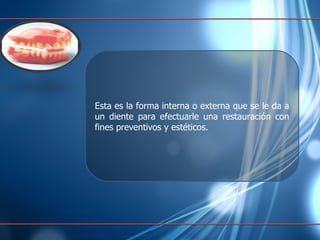 Esta es la  forma  interna  o  externa   que  se le  da  a un  diente   para   efectuarle   una   restauración  con fines  preventivos  y  estéticos. 