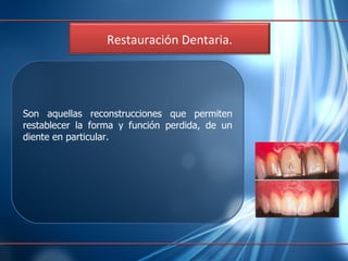 Son aquellas reconstrucciones que permiten restablecer la forma y función perdida, de un diente en particular. Restauración Dentaria. 