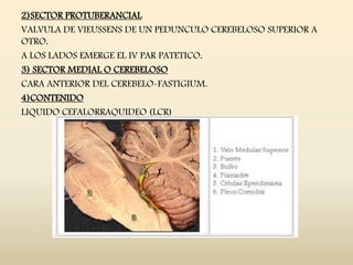 2)SECTOR PROTUBERANCIAL
VALVULA DE VIEUSSENS DE UN PEDUNCULO CEREBELOSO SUPERIOR A
OTRO.
A LOS LADOS EMERGE EL IV PAR PATETICO.
3) SECTOR MEDIAL O CEREBELOSO
CARA ANTERIOR DEL CEREBELO-FASTIGIUM.
4)CONTENIDO
LIQUIDO CEFALORRAQUIDEO (LCR)
 