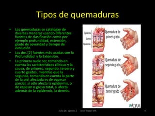 Clasificación de las quemaduras por profundidad