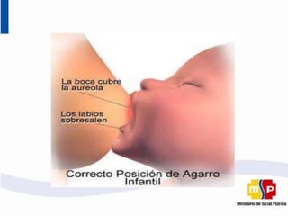 Tecnicas de amamantamiento y extraccion