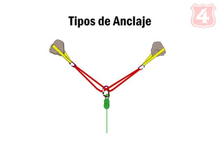 Tipos de Anclaje
 