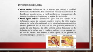 ENFERMEDADES DELOIDO:
 Otitis media: inflamación de la mucosa que reviste la cavidad
timpánica del oído medio. Esta inflamación produce la acumulación de
liquido con aspecto seroso, se puede producir por consecuencias a la
falta de aireación y un descenso en la presión del oído medio.
 Otitis aguda externa: inflamación aguda del oído externo es la
inflamación aguda del conducto auditivo externo. La otitis externa
circunscrita es la inflamación del tercio lateral del conducto auditivo
externo producida por la infección de una glándula pilosebácea a
cauda de una bacteria. La otitis externa difusa bacteriana es la
infección de la piel de todo el conducto auditivo externo causado por
el uso de hisopos para limpiar el oído, aguas de las piscinas o
erosiones de la piel a este nivel.
 