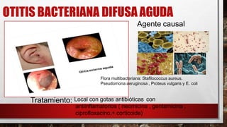OTITIS BACTERIANA DIFUSAAGUDA
Agente causal
Flora multibacteriana: Stafilococcus aureus,
Pseudomona aeruginosa , Proteus vulgaris y E. coli
Tratamiento: Local con gotas antibióticas con
antiinflamatorios ( neomicina , gentamicina ,
ciprofloxacino,+ corticoide)
 