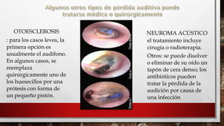 OTOESCLEROSIS NEUROMA ACÚSTICO

: para los casos leves, la
primera opción es
usualmente el audífono.
En algunos casos, se
reemplaza
quirúrgicamente uno de
los huesecillos por una
prótesis con forma de
un pequeño pistón.


el tratamiento incluye
cirugía o radioterapia.
Otros: se puede disolver
o eliminar de su oído un
tapón de cera denso; los
antibióticos pueden
tratar la pérdida de la
audición por causa de
una infección
 