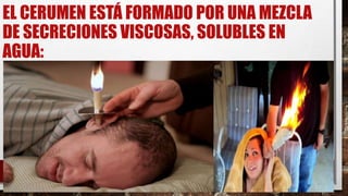 EL CERUMEN ESTÁ FORMADO POR UNA MEZCLA
DE SECRECIONES VISCOSAS, SOLUBLES EN
AGUA:
 