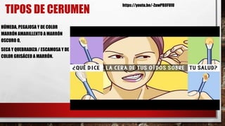 TIPOS DE CERUMEN
HÚMEDA, PEGAJOSA Y DE COLOR
MARRÓN AMARILLENTO A MARRÓN
OSCURO O,
SECA Y QUEBRADIZA / ESCAMOSA Y DE
COLOR GRISÁCEO A MARRÓN.
https://youtu.be/-ZuwPB0FUIU
 
