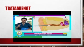 TRATAMIENOT
 