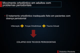 Movimento ortodôntico em adultos com
problemas periodontais
Ortodontia e Periodontia
 O tratamento ortodôntico inadequado feito em pacientes com
doença periodontal
COLAPSO DOS TECIDOS PERIODONTAIS
Inflamação Forças Ortodônticas Trauma Oclusal
 