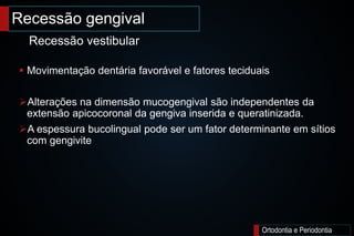 Recessão gengival
Ortodontia e Periodontia
 Movimentação dentária favorável e fatores teciduais
Alterações na dimensão mucogengival são independentes da
extensão apicocoronal da gengiva inserida e queratinizada.
A espessura bucolingual pode ser um fator determinante em sítios
com gengivite
Recessão vestibular
 