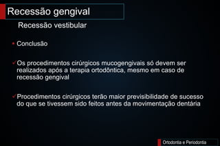 Recessão gengival
Ortodontia e Periodontia
 Conclusão
Os procedimentos cirúrgicos mucogengivais só devem ser
realizados após a terapia ortodôntica, mesmo em caso de
recessão gengival
Procedimentos cirúrgicos terão maior previsibilidade de sucesso
do que se tivessem sido feitos antes da movimentação dentária
Recessão vestibular
 