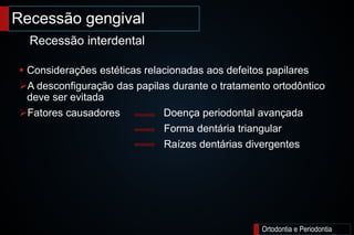 Recessão gengival
Ortodontia e Periodontia
 Considerações estéticas relacionadas aos defeitos papilares
A desconfiguração das papilas durante o tratamento ortodôntico
deve ser evitada
Fatores causadores Doença periodontal avançada
Forma dentária triangular
Raízes dentárias divergentes
Recessão interdental
 