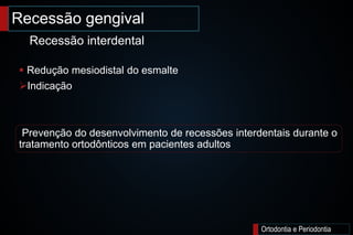 Ortodontia e Periodontia
 Redução mesiodistal do esmalte
Indicação
Prevenção do desenvolvimento de recessões interdentais durante o
tratamento ortodônticos em pacientes adultos
Recessão gengival
Recessão interdental
 
