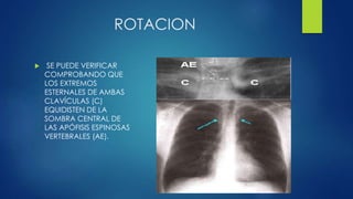 ROTACION
 SE PUEDE VERIFICAR
COMPROBANDO QUE
LOS EXTREMOS
ESTERNALES DE AMBAS
CLAVÍCULAS (C)
EQUIDISTEN DE LA
SOMBRA CENTRAL DE
LAS APÓFISIS ESPINOSAS
VERTEBRALES (AE).
 
