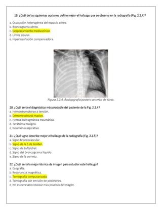 19. ¿Cuál de las siguientes opciones define mejor el hallazgo que se observa en la radiografía (Fig. 2.2.4)?
a. Ocupación heterogénea del espacio aéreo.  
b. Broncograma aéreo.  
c. Desplazamiento mediastínico.  
d. Límite cisural.  
e. Hiperinsuflación compensadora.  
 
Figura 2.2.4. Radiopgrafía postero-anterior de tórax.
20. ¿Cuál sería el diagnóstico más probable del paciente de la Fig. 2.2.4?
a. Hemoneumotorax a tensión.  
b. Derrame pleural masivo.  
c. Hernia diafragmática traumática.  
d. Teratoma maligno.  
e. Neumonía aspirativa.  
21. ¿Qué signo describe mejor el hallazgo de la radiografía (Fig. 2.2.5)?
a. Signo broncovascular.  
b. Signo de la S de Golden.  
c. Signo de Luftsichel.  
d. Signo del broncograma líquido.  
e. Signo de la cometa.  
22. ¿Cuál sería la mejor técnica de imagen para estudiar este hallazgo?
a. Ecografía.  
b. Resonancia magnética.  
c. Tomografía computarizada.  
d. Tomografía por emisión de positrones.  
e. No es necesario realizar más pruebas de imagen.  
 