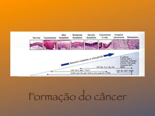 Formação do câncer
 