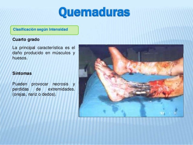 Lesiones, Heridas, Quemaduras. Lesiones, Heridas, Quemaduras.