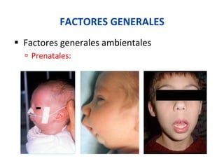 FACTORES	
  GENERALES	
  
§  Factores	
  generales	
  ambientales	
  
ú  Prenatales:	
  postura	
  del	
  feto,	
  enfermedades	
  de	
  la	
  madre	
  durante	
  
en	
  embarazo.	
  
 