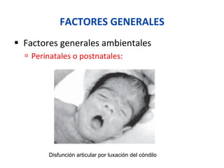 FACTORES	
  GENERALES	
  
§  Factores	
  generales	
  ambientales	
  
ú  Perinatales	
  o	
  postnatales:	
  lesión	
  o	
  luxación	
  del	
  cóndilo	
  
Disfunción articular por luxación del cóndilo
 