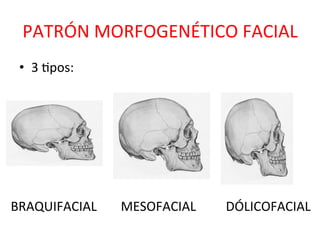 PATRÓN	
  MORFOGENÉTICO	
  FACIAL	
  
•  3	
  0pos:	
  
BRAQUIFACIAL	
   MESOFACIAL	
   DÓLICOFACIAL	
  
 