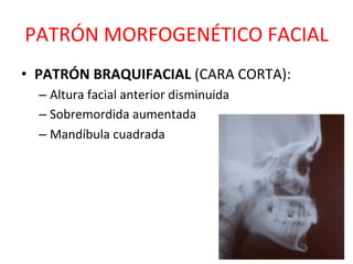 PATRÓN	
  MORFOGENÉTICO	
  FACIAL	
  
•  PATRÓN	
  BRAQUIFACIAL	
  (CARA	
  CORTA):	
  
– Altura	
  facial	
  anterior	
  disminuida	
  
– Sobremordida	
  aumentada	
  
– Mandíbula	
  cuadrada	
  
 
