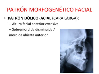 PATRÓN	
  MORFOGENÉTICO	
  FACIAL	
  
•  PATRÓN	
  DÓLICOFACIAL	
  (CARA	
  LARGA):	
  
– Altura	
  facial	
  anterior	
  excesiva	
  
– Sobremordida	
  disminuida	
  /	
  	
  
mordida	
  abierta	
  anterior	
  
 