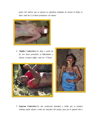 partes del cadáver que se apoyan en superficies inclinadas de terreno la lividez se 
inicia entre las 3 y 6 horas posteriores a la muerte. 
4. Rigidez Cadavérica: Se inicia a partir de 
las tres horas posteriores al fallecimiento y 
alcanza su mayor rigidez entre las 15 horas. 
5. Espasmo Cadavérico: Es una contracción inmediata y súbita que se produce 
violentas puede afectar a todos los músculos del cuerpo, pero por lo general sólo a 
 