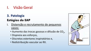 I. Visão Geral
3. Patologia
Estágios do EAP
i. Distensão e recrutamento de pequenos
vasos:
• Aumento das trocas gasosas e difusão de CO2,
• Dispneia aos esforços,
• Discretos estertores inspiratórios e,
• Redistribuição vascular ao RX.
 