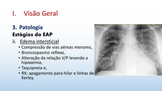 I. Visão Geral
3. Patologia
Estágios do EAP
ii. Edema intersticial
• Compressão de vias aéreas menores,
• Broncospasmo reflexo,
• Alteração da relação V/P levando a
hipoxemia,
• Taquipneia e,
• RX: apagamento para-hilar e linhas de
Kerley.
 
