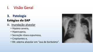 I. Visão Geral
3. Patologia
Estágios do EAP
iii. Inundação alveolar
• Hipóxia severa,
• Hipercapnia,
• Secreção rósea espumosa,
• Crepitantes e,
• RX: edema alveolar em “asa de borboleta”.
 