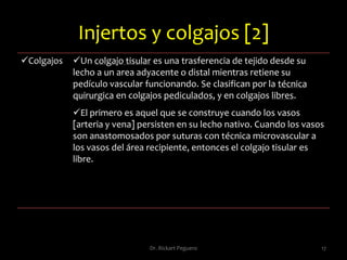 Úlceras  13Dr. Rickart Peguero