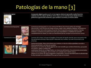 Tierra de nadie Tierra de nadie. Es la zona comprendida entre la parte media de la palma de la mano distal a las articulaciones interfalangicas proximales, la llamada zona 2. [Ver figura]. 